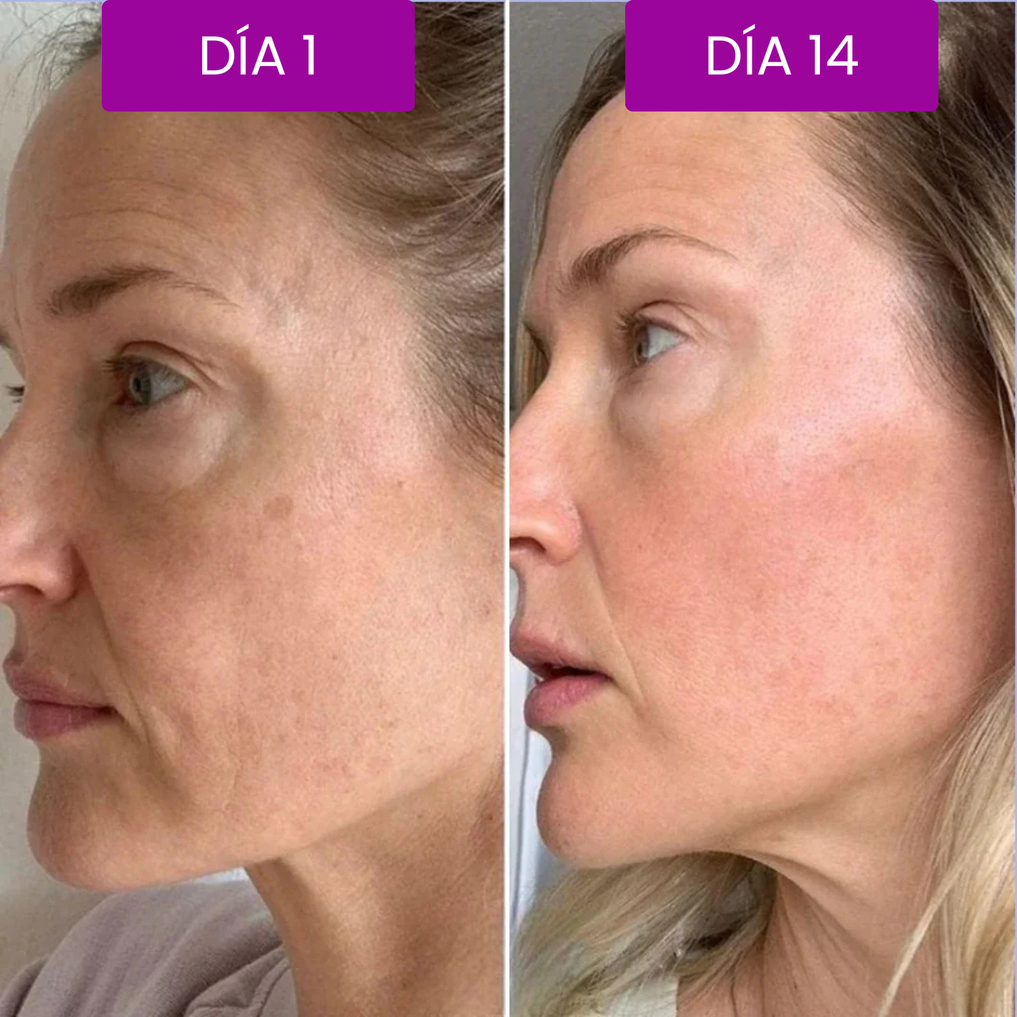 Bálsamo Coreano Efecto Lifting - Dr.Melaxin.