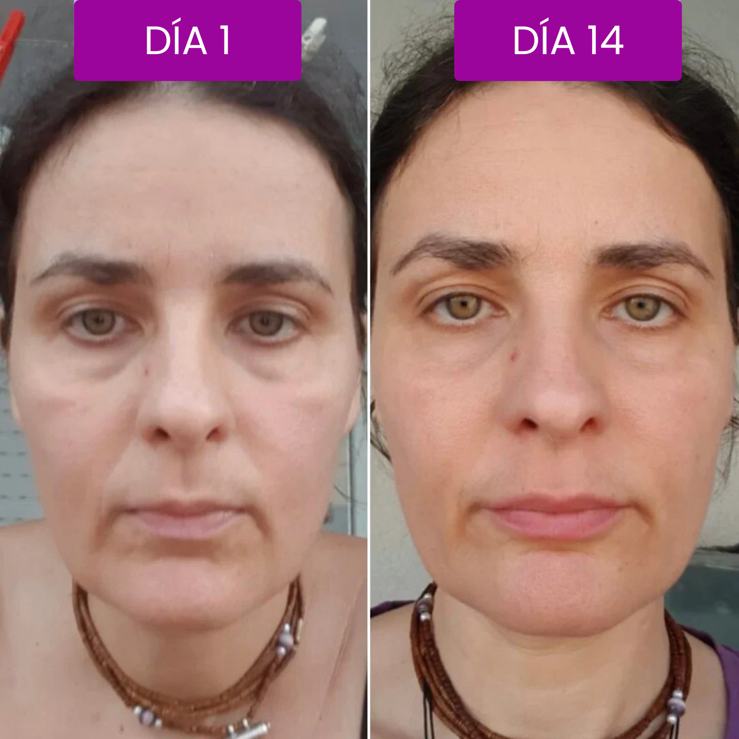 Bálsamo Coreano Efecto Lifting - Dr.Melaxin.