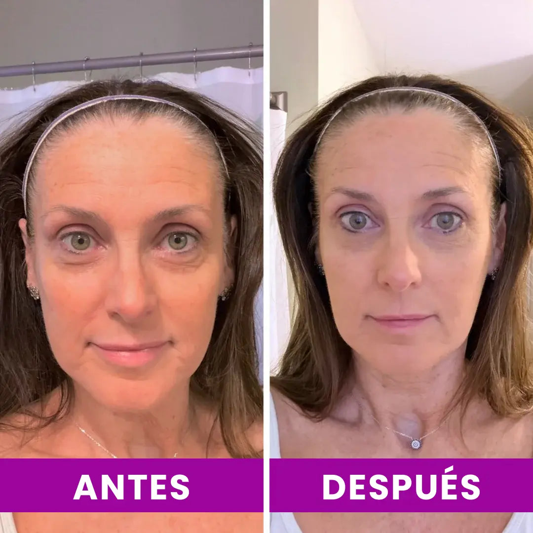 Dr.Melaxin - Bálsamo Coreano Efecto Lifting