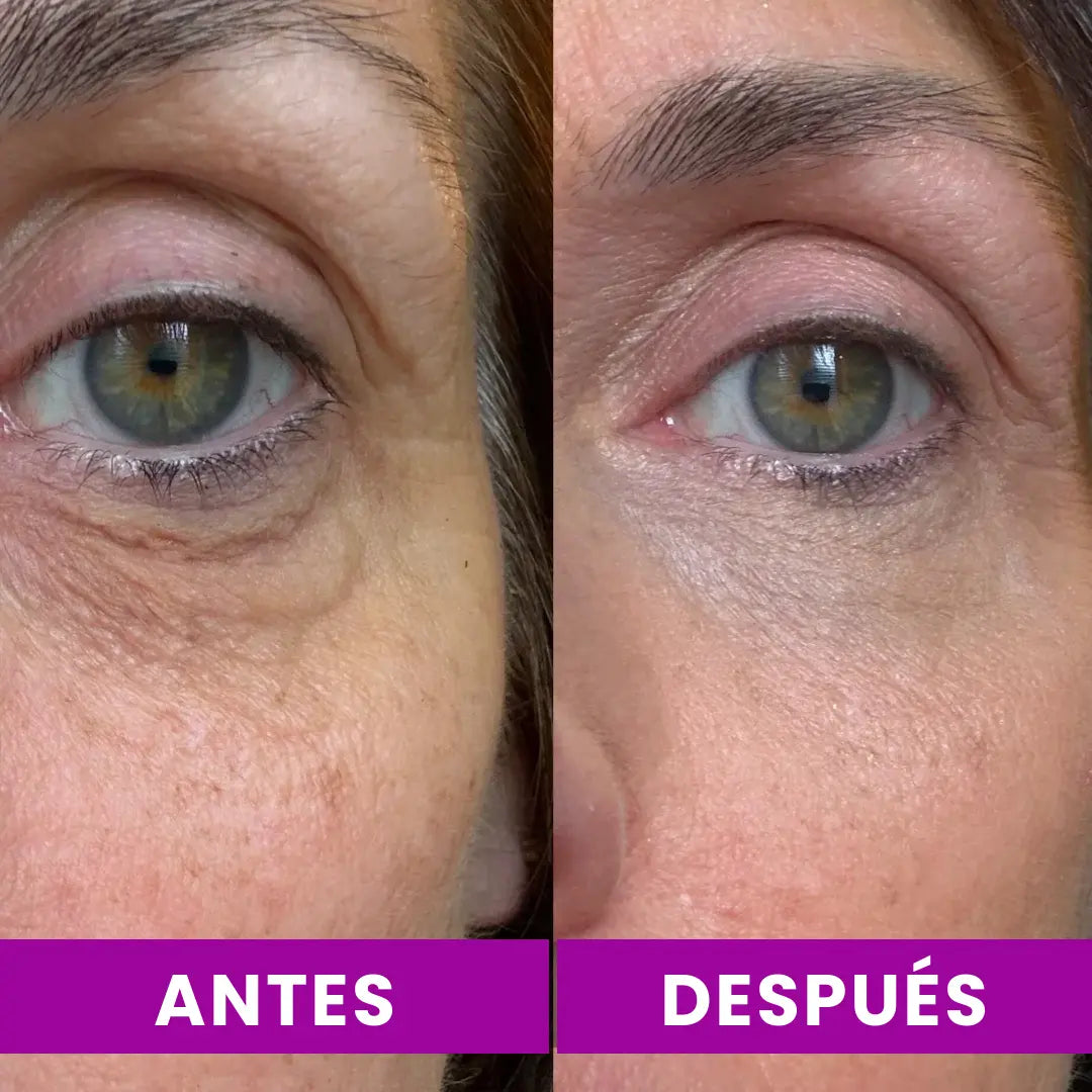 Dr.Melaxin - Bálsamo Coreano Efecto Lifting